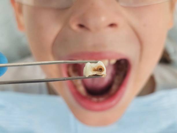 Best Emergency Dental Services Near Me  in Commercial Point, OH