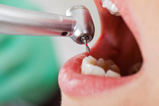 Best Knocked-Out Tooth Emergency  in Commercial Point, OH